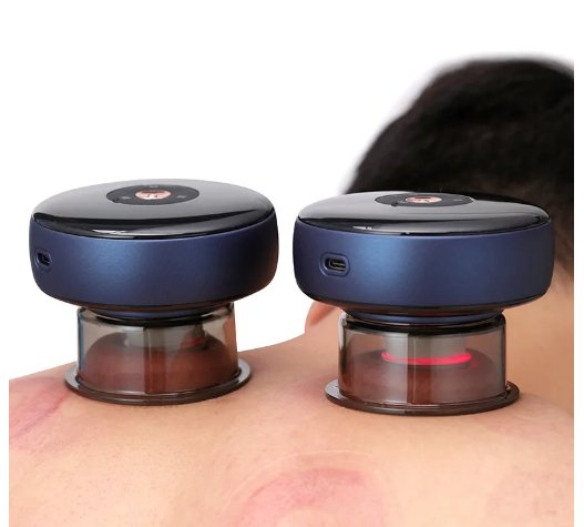 Electric Cupping Therapy Massager – Deep Tissue Relief