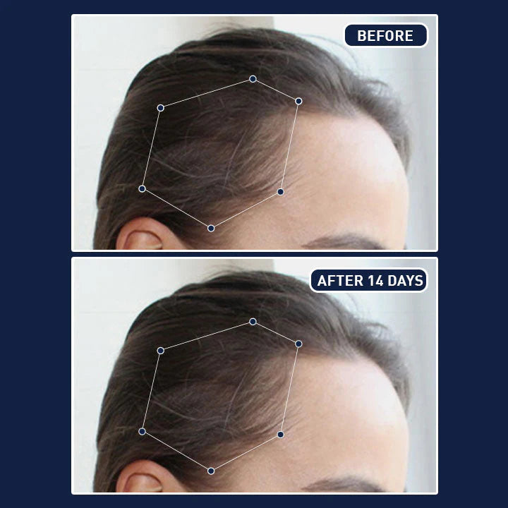 FEG Plus Herbal Hair Growth Mist