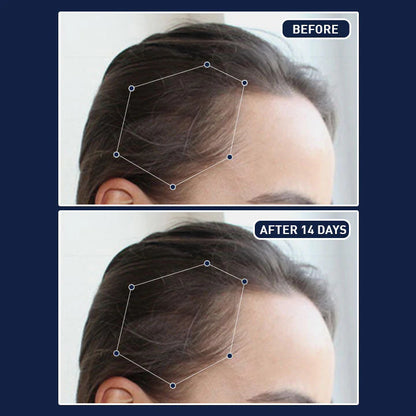 FEG Plus Herbal Hair Growth Mist